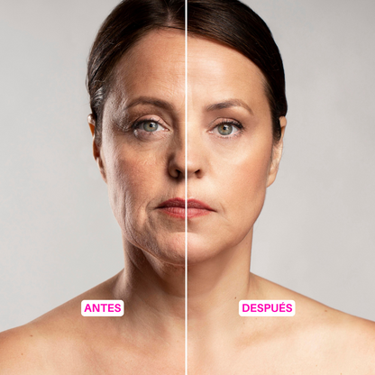 DermoLift | Dispositivo de Microcorriente Antiarrugas - Efecto Lifting y Rejuvenecimiento